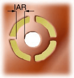 Thermal Pad IAR